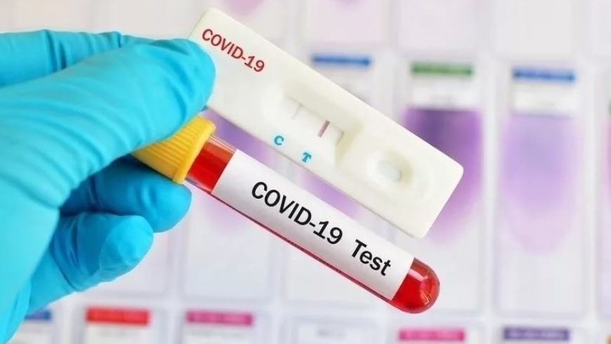 В Калмыкии за сутки выявлены 102 новых случая заболевания коронавирусом