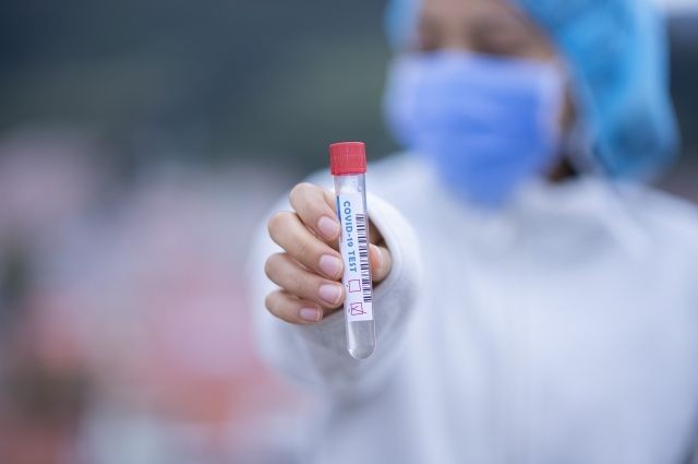 За сутки выявлены 16 новых случаев заражения коронавирусом