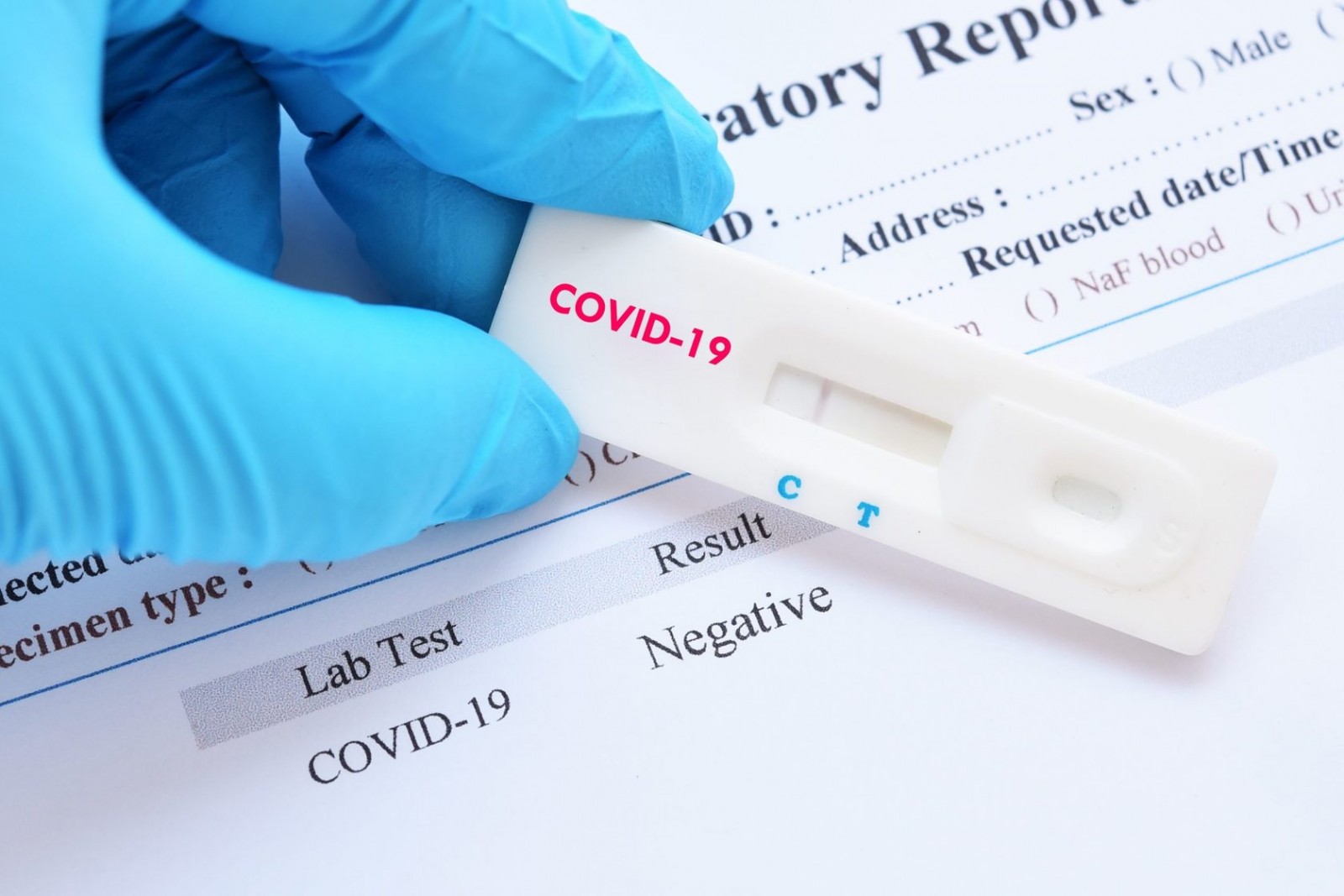 За минувшие сутки выявлены 10 новых случаев заражения коронавирусом
