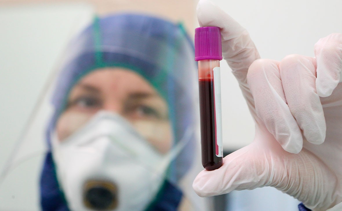 В Калмыкии за сутки зарегистрировано 69 новых случаев заражения коронавирусом