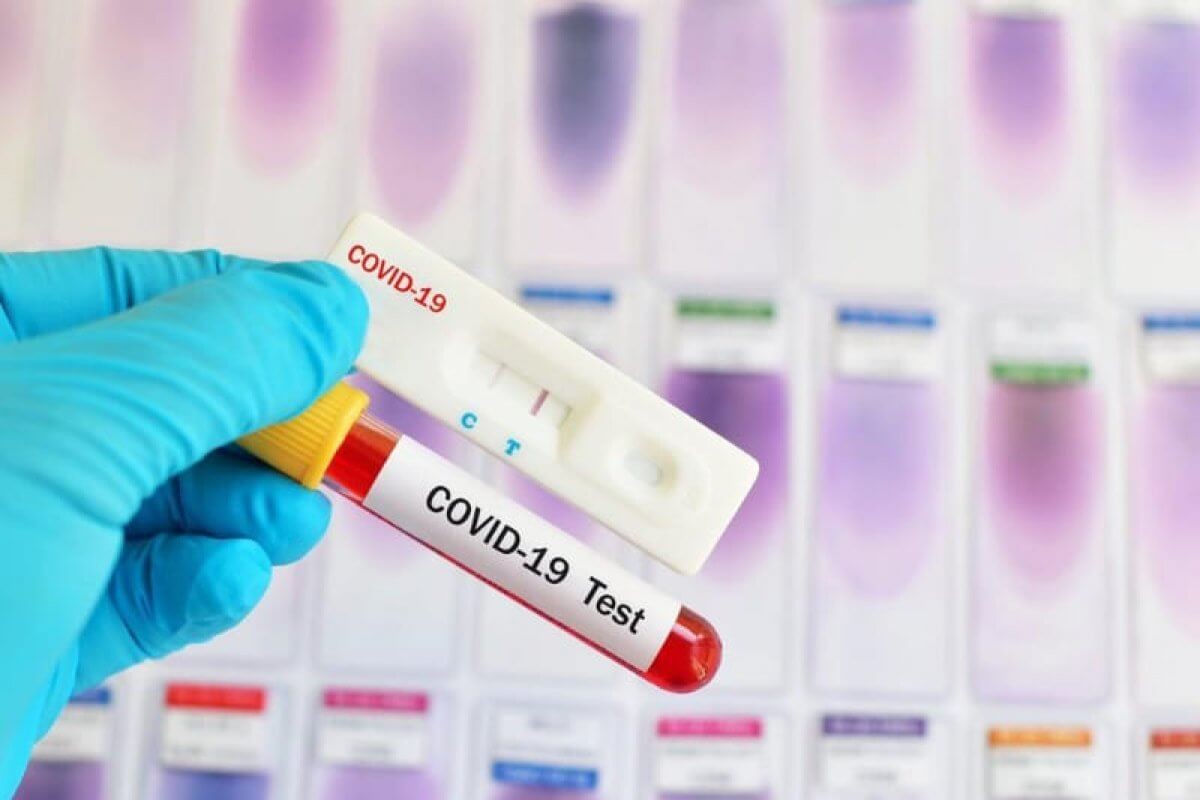 За сутки выявлен 71 новый случай заражения коронавируса