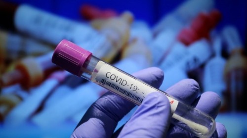 За минувшие сутки в Калмыкии выявлено 255 новых случаев заражения коронавирусом