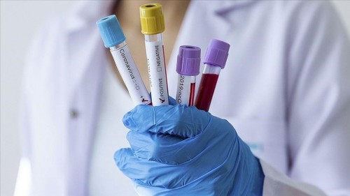 За сутки в Калмыкии выявлены 86 новых случаев заражения