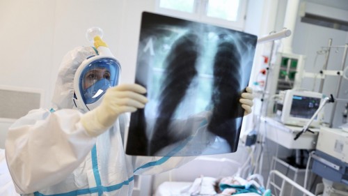 Жертвами коронавируса в Калмыкии стали еще четыре человека