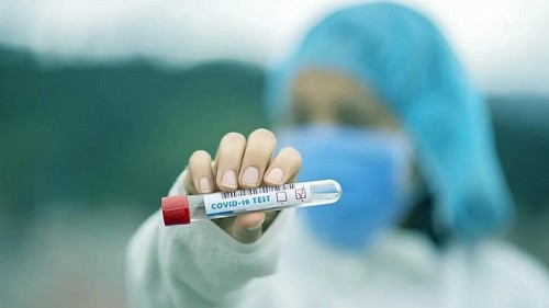 В Калмыкии за сутки выявлены 110 новых случаев заболевания коронавирусом