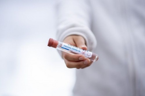 В Калмыкии за минувшие сутки выявлен 91 новый случай заражения коронавирусом