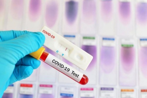 За сутки выявлен 71 новый случай заражения коронавируса