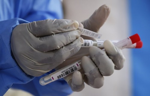За сутки в Калмыкии выявлено 115 новых случаев заражения  коронавирусом