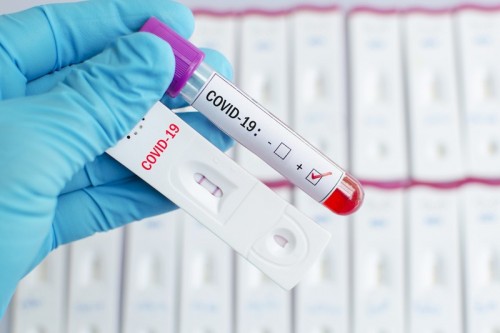 В Калмыкии выявлены 40 новых случаев заражения коронавирусом