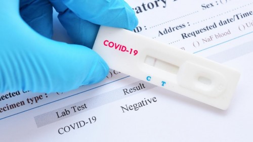 За сутки зарегистрировано еще 2 летальных исхода от коронавируса