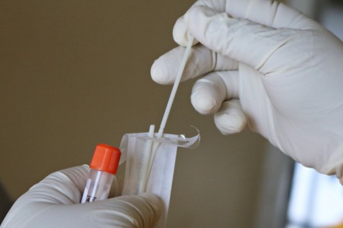 За минувшие сутки выявлены 97 новых случаев заражения коронавирусом