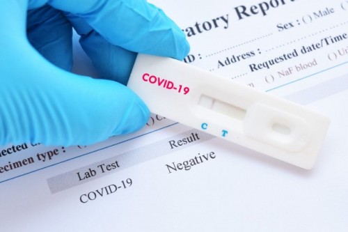За сутки выявлены 11 новых случаев заражения  коронавирусом