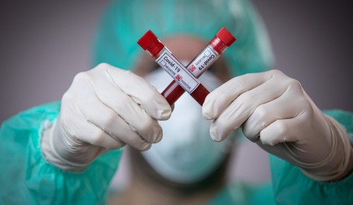 За сутки выявлены 14 новых случаев заражения коронавирусом