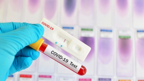 Выявлены еще 12  случаев заражения коронавирусом