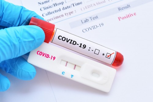 За сутки выявлены 13 новых случаев заражения коронавирусом