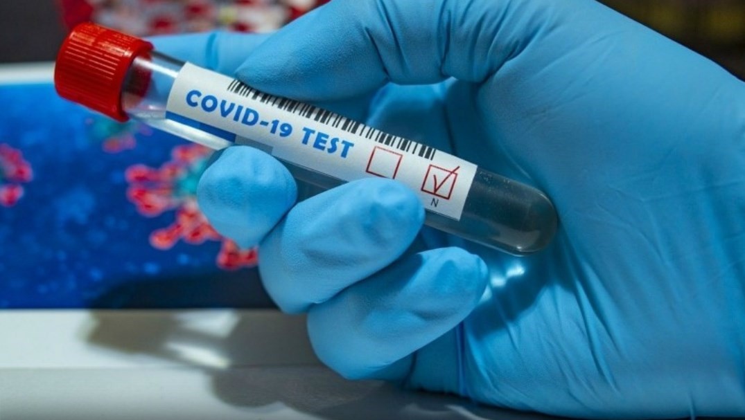 За сутки в Калмыкии выявлены 85 новых случаев заражения коронавирусом