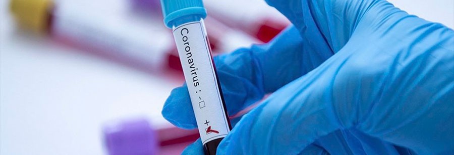 Выявлен 21 новый случай заражения коронавирусом