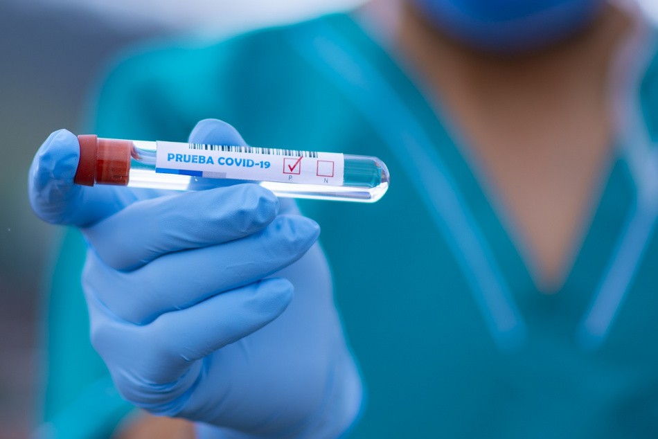 За минувшие сутки выявлено 37 новых случаев заражения коронавирусом