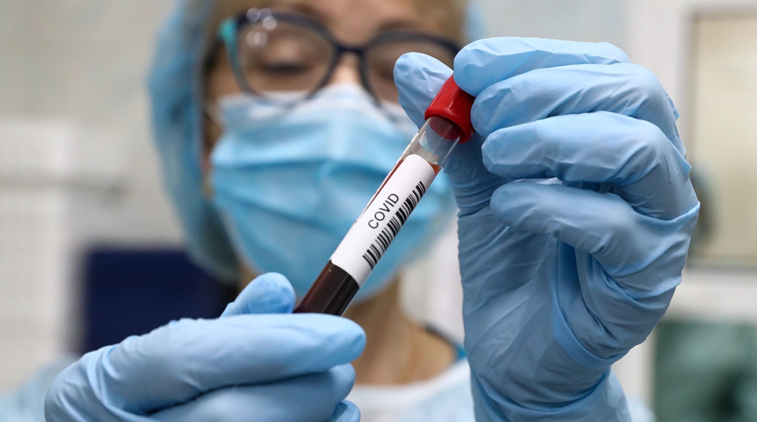 За сутки выявлены 12 новых случаев заражения коронавирусом