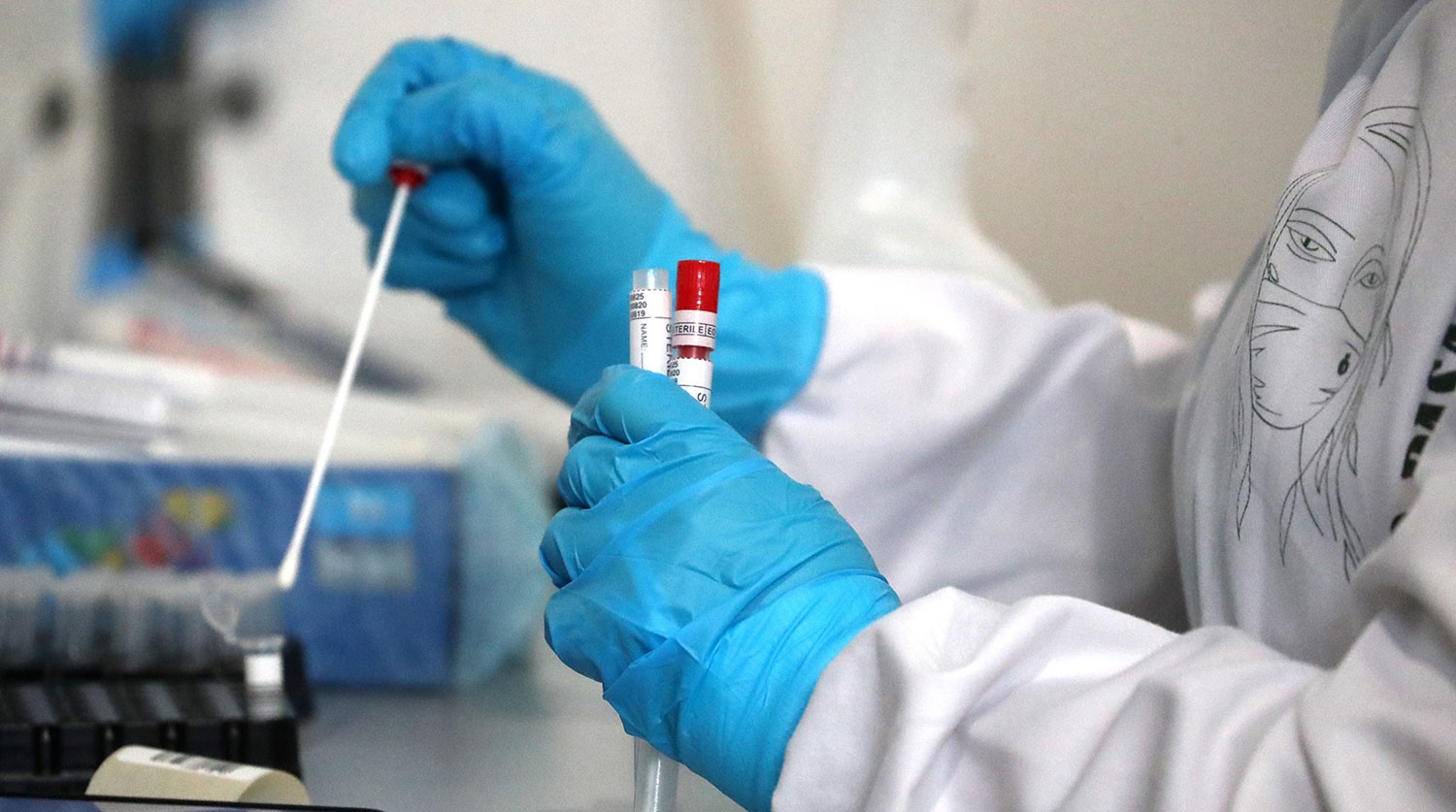В Калмыкии выявлены 25 новых случаев заражения коронавирусом